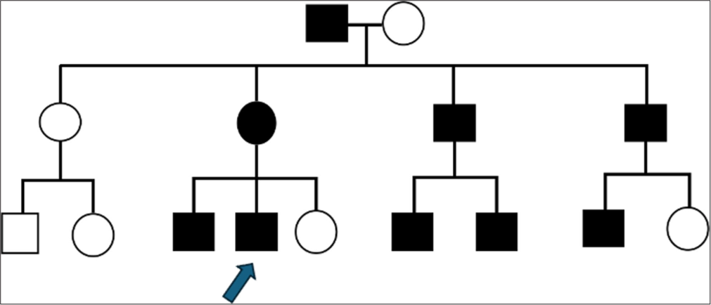 Pedigree of the family. The index case is indicated by an arrow. Black-filled symbols indicate affected members.